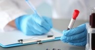 First-Ever Detection For Early Head And Neck Cancers Under Development