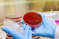Un bot latinoamericano se adelanta al diagnóstico. Una inteligencia artificial que interpreta bacterias y promete cambiar la salud pública