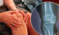Study shows rheumatoid arthritis begins years before symptoms appear
