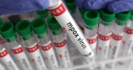 Mpox sigue presente en Chile, pero con drástica reducción: de 1.402 casos el primer año a 186 en 2025