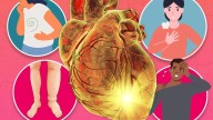 From cankles to sweaty pits - the 12 subtle signs of heart disease that kills 1 in 3