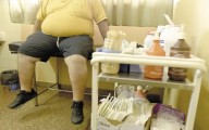 Más del 80% de los pacientes con diabetes tienen obesidad