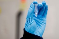 At-home skin cancer tests show early promise, University of Michigan researchers say