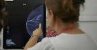 'We're going to save lives': Routine breast cancer test could be used to screen heart disease