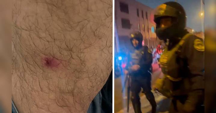 Tres periodistas son agredidos por la PNP: dos recibieron impactados de perdigones