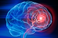 Stem Cell Transplant in Mice Makes Stroke Recovery Possible