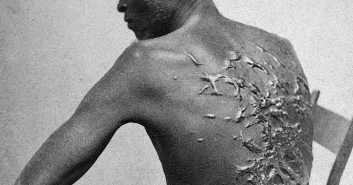 Louisiana's "Whipped Pete" at center of national controversy