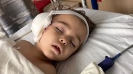 St. Johns County mother seeks community help after dog attacks 3