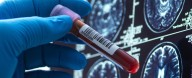 World Alzheimer's Day: Here's How Far We've Come in Search of a Cure