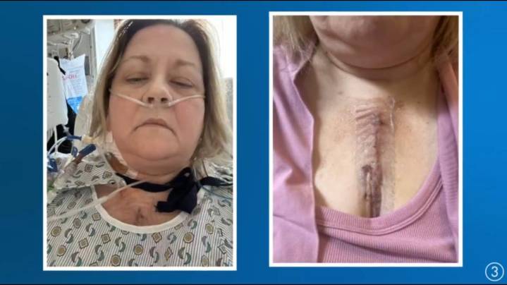 ‘I was in heart failure’: Youngstown teacher cautions women not to ignore heart symptoms