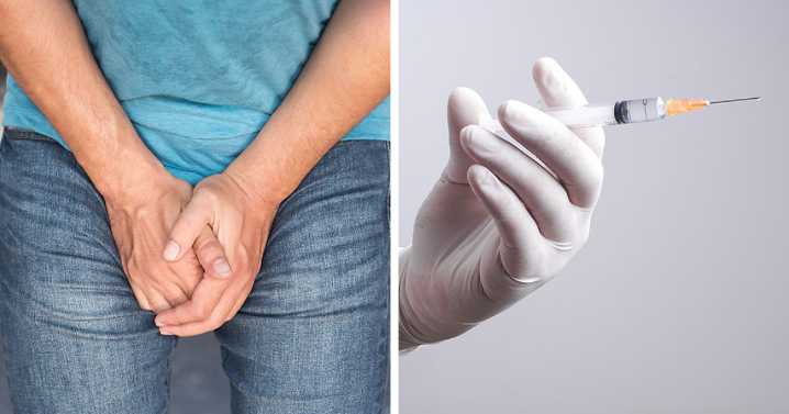 What Is ‘Scrotox’? Doctors Issue Warning Against Rising Cosmetic Trend Among Men