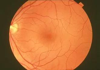 Cirugía argentina revoluciona la oftalmología y gana el “Óscar de la retina”
