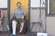 ‘Definitely painful’: Jacksonville man believes he was infected with flesh