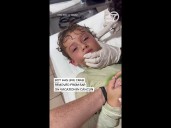 Live crab removed from boy's ear on Cancun vacation