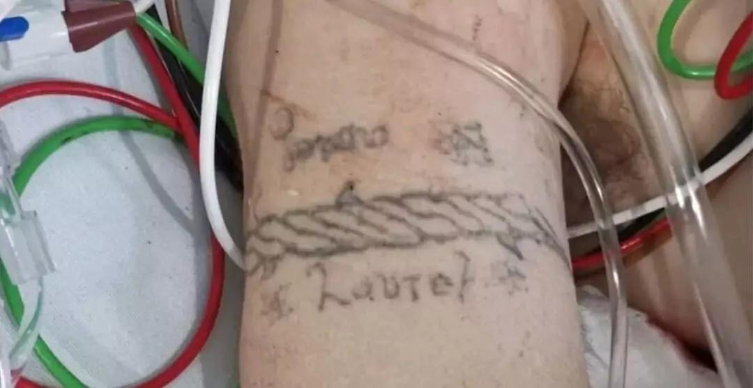 ¿Quién es la joven quemada en Iztapalapa? Misterio sin resolver tras explosión de pipa de gas