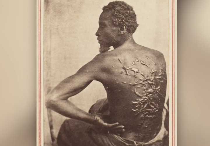 Trump Admin Doesn’t Want You To See The Scars Of Slavery