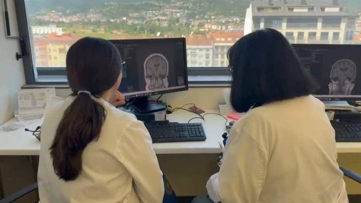 Investigadores de la Universidad de Santiago consiguen anticipar el alzheimer 15 años antes de que aparezca