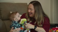 Life-changing facial reconstruction surgery nears for Rockwall baby with defect