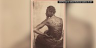 Washington Post: Trump orders National Gallery of Art to remove photo of slave with scarred back
