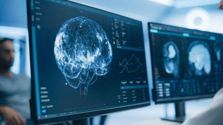 How you MOVE could reveal an early sign of Alzheimer’s disease