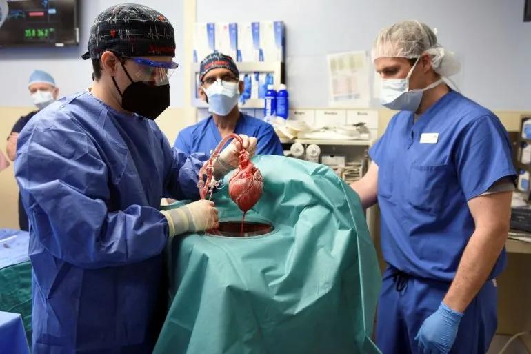 El HHS decide cerrar un importante grupo de donación de órganos, en su último paso para reformar el sistema de trasplantes del país.