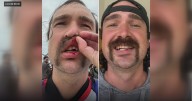 Huntington Beach dentist helps Marine veteran who broke tooth while surfing