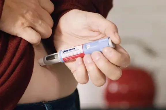 Cara de Ozempic”: los efectos estéticos tras la pérdida de peso y la importancia del control médico