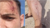 Dos ganaderos agreden a un redactor y a un cámara de À Punt en Alcalà de Xivert