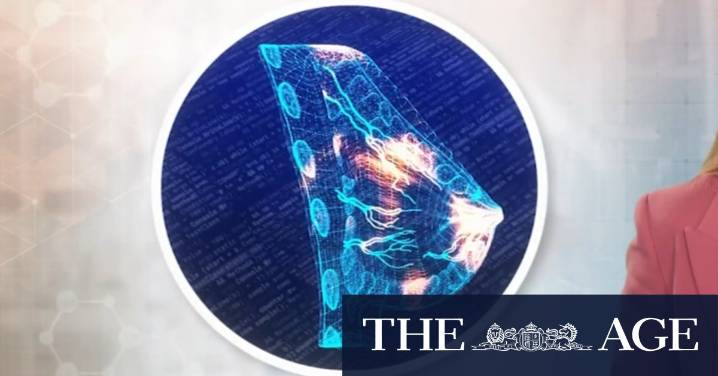 New mammogram machine can detect heart disease in women