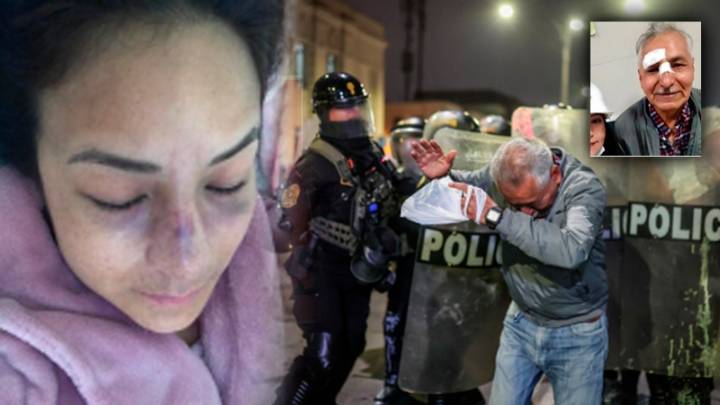 Ricardo Belmont y camarógrafa de Habla el Pueblo fueron víctimas de agresión policial