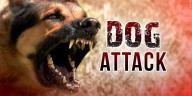 Woman dies after dog attack