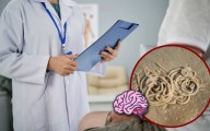 Fue al doctor por migrañas y descubrió que tenía parásitos en el cerebro por comer tocino crudo