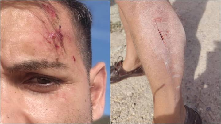 Dos ganaderos agreden a un redactor y a un cámara de À Punt en Alcalà de Xivert
