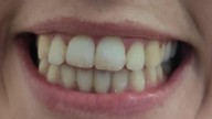 Color de los dientes: qué nos dicen los tonos rosados, amarillos o negros y cuándo acudir al dentista