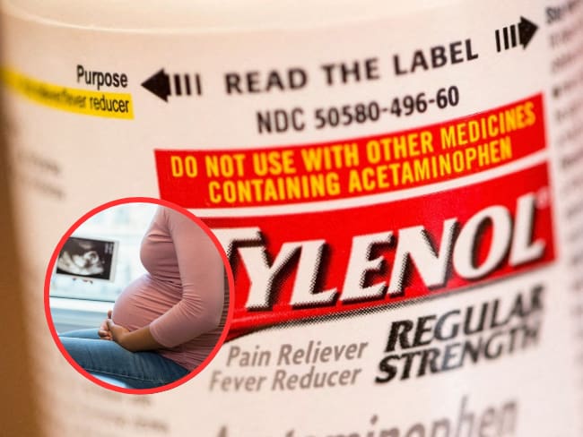 FDA aprueba tratamiento para el autismo y pide limitar uso de acetaminofén durante el embarazo