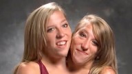 Conjoined twins Abby and Brittany Hensel respond to viral baby photos