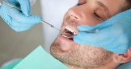 Mouth Microbes Might Contribute To Pancreatic Cancer