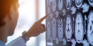 Identifican un mecanismo que le permite al cerebro seleccionar información relevante
