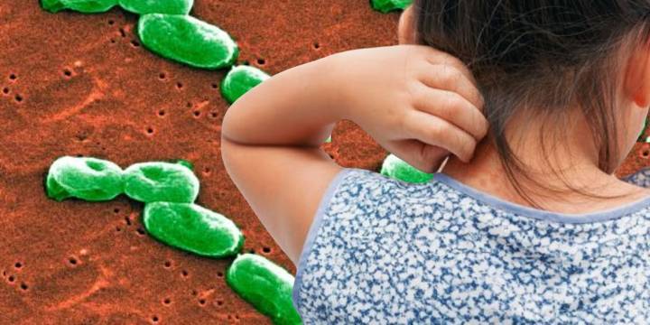 Ralstonia pickettii, la bacteria que infectó a 12 niños en el INSN de San Borja: qué es, síntomas y por qué puede llegar a ser mortal