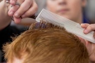 What you eat and drink can contribute to your hair loss