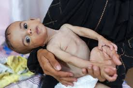 ¡Hasta cuándo!: Ya son 145 los niños muertos de hambre en Gaza debido al bloqueo israelí de suministros