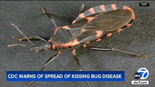 CDC warns of spread of Chagas disease from 'kissing bugs,' says it could become endemic illness in US