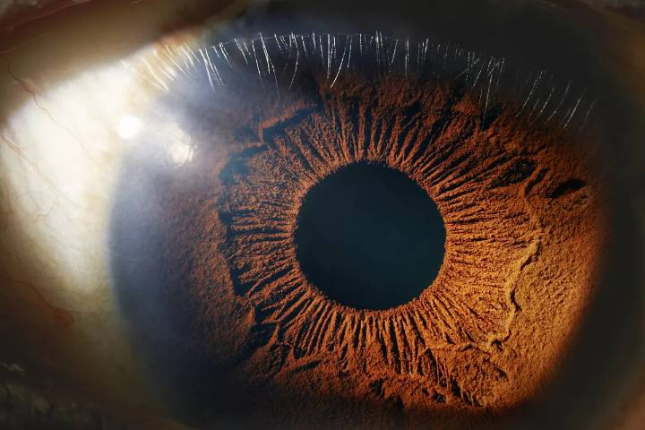 Los ojos esconden pistas del inicio de enfermedades sistémicas y tumorales