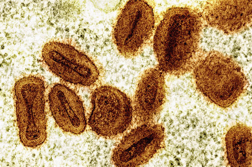 Brote de viruela símica en África ya no es una emergencia de salud global, dice OMS