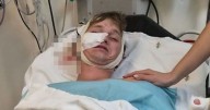 Stag do reveller brutally mauled by HYENAS after heavy night drinking