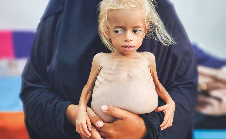 El último refugio de los niños de Gaza: el único hospital que sigue en pie