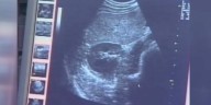 Lawmakers voice concern on issue of paid parental leave for stillbirths in SC