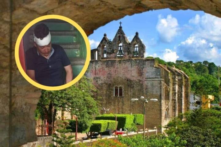 Iba en combi de Huejutla, pero se soltó y se cayó; al parecer estaba ebrio, afirman