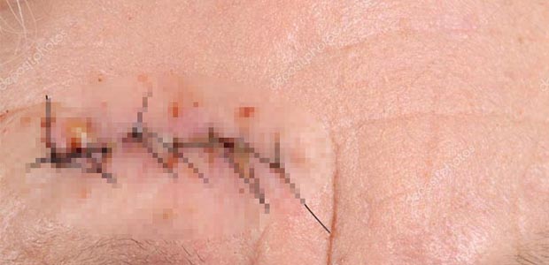 General Villegas: una persona debió ser suturada en el rostro al sufrir heridas en medio de la tormenta