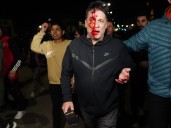 Habló Cristian Mercatante, el cronista herido en el cierre de campaña de Milei: "Este impacto a un nene lo mata"